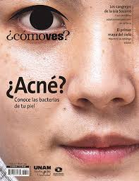¿Cómo ves? Revista de Divulgación de la Ciencia, año 27, núm. 314, enero de 2025. ¿Acné? Conoce las bacterias de tu piel