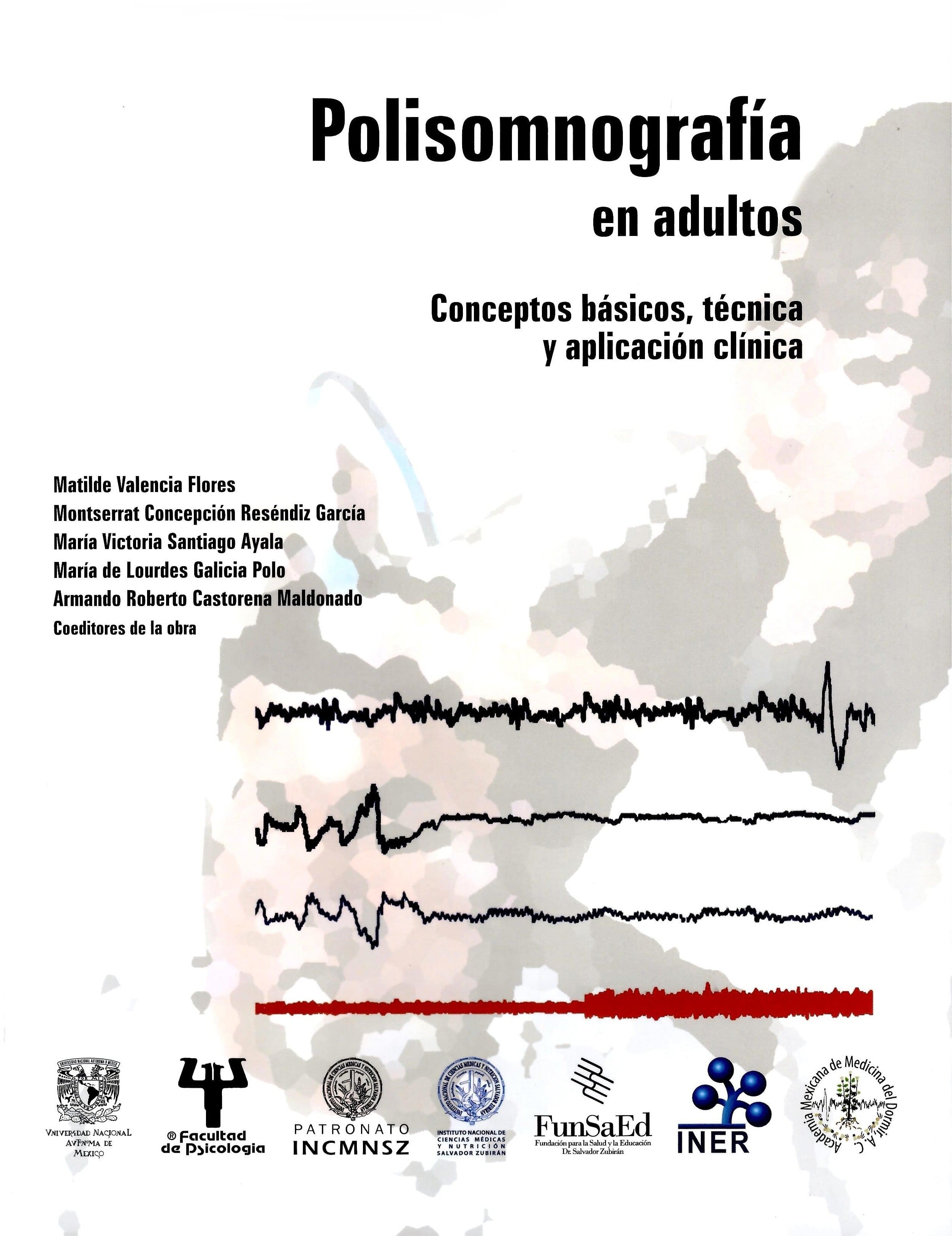 Polisomnografía en adultos. Conceptos básicos, técnica y aplicación clínica